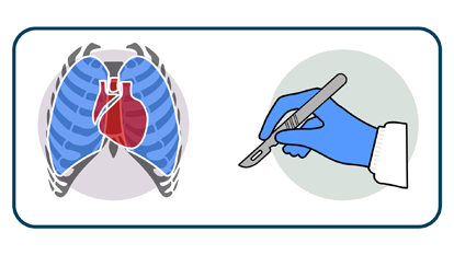 Thoracic Surgery